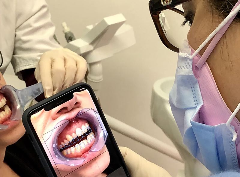 Una paziente mostra il sorriso su uno smartphone durante la visita di ortodonzia invisibile