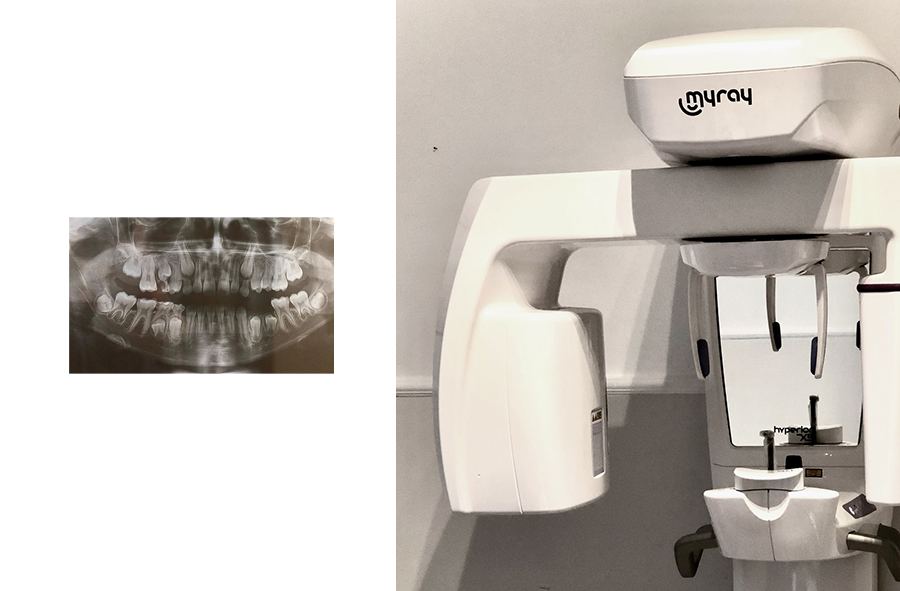 L'apparecchio per la radiografia panoramica dello studio